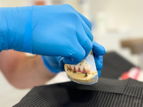 Ai dinți lipsă? Soluții moderne la Ilies Dental Clinic