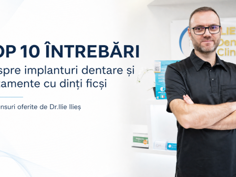 Top 10 întrebări și răspunsuri despre tratamentele cu implanturi dentare