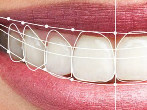 Digital Smile Design